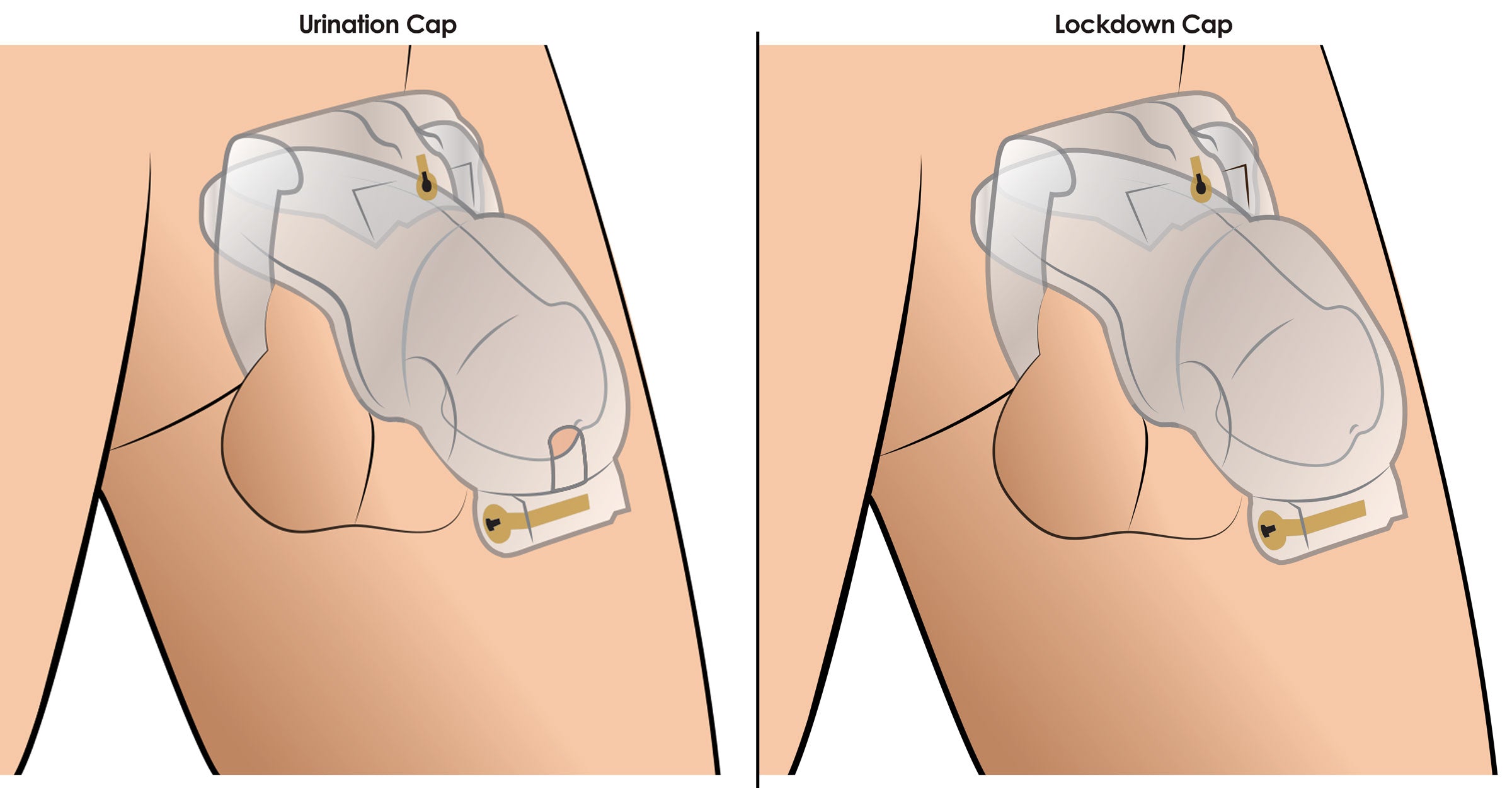 Lockdown Customizable Chastity Cage -