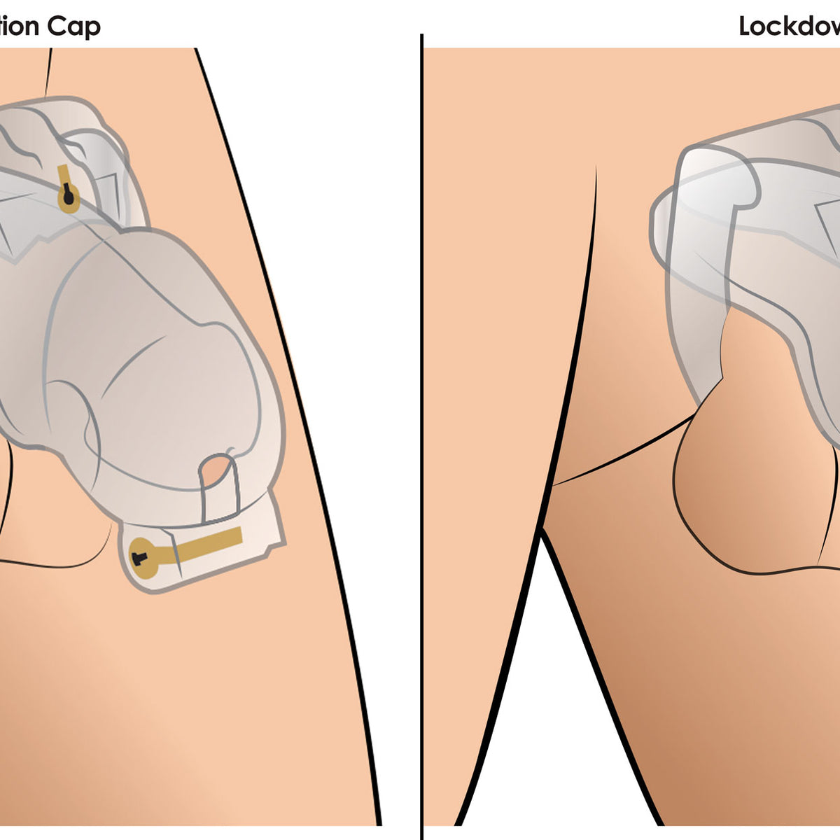 Lockdown Customizable Chastity Cage -